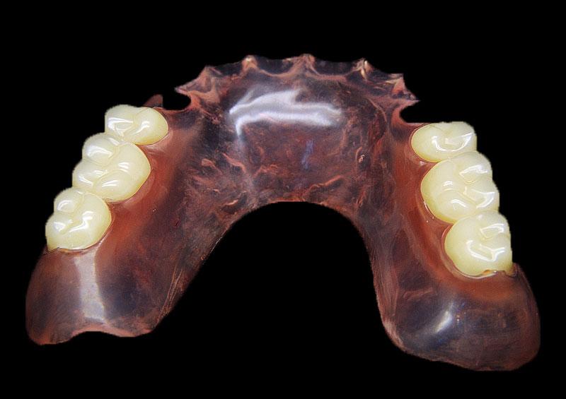 Valplast