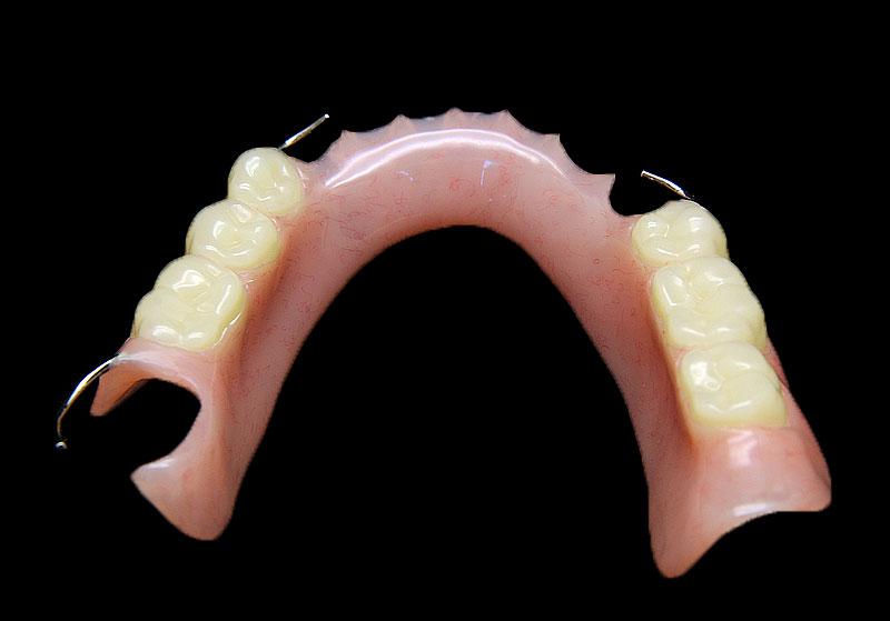 Partial-denture